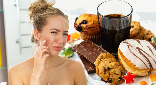 HOLIDAY DIETS VS. HAPPY SKIN: HOW TO AVOID FLARE-UPS THIS SEASON
