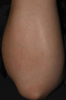 After Image
