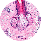 Čištění (Exfoliace)