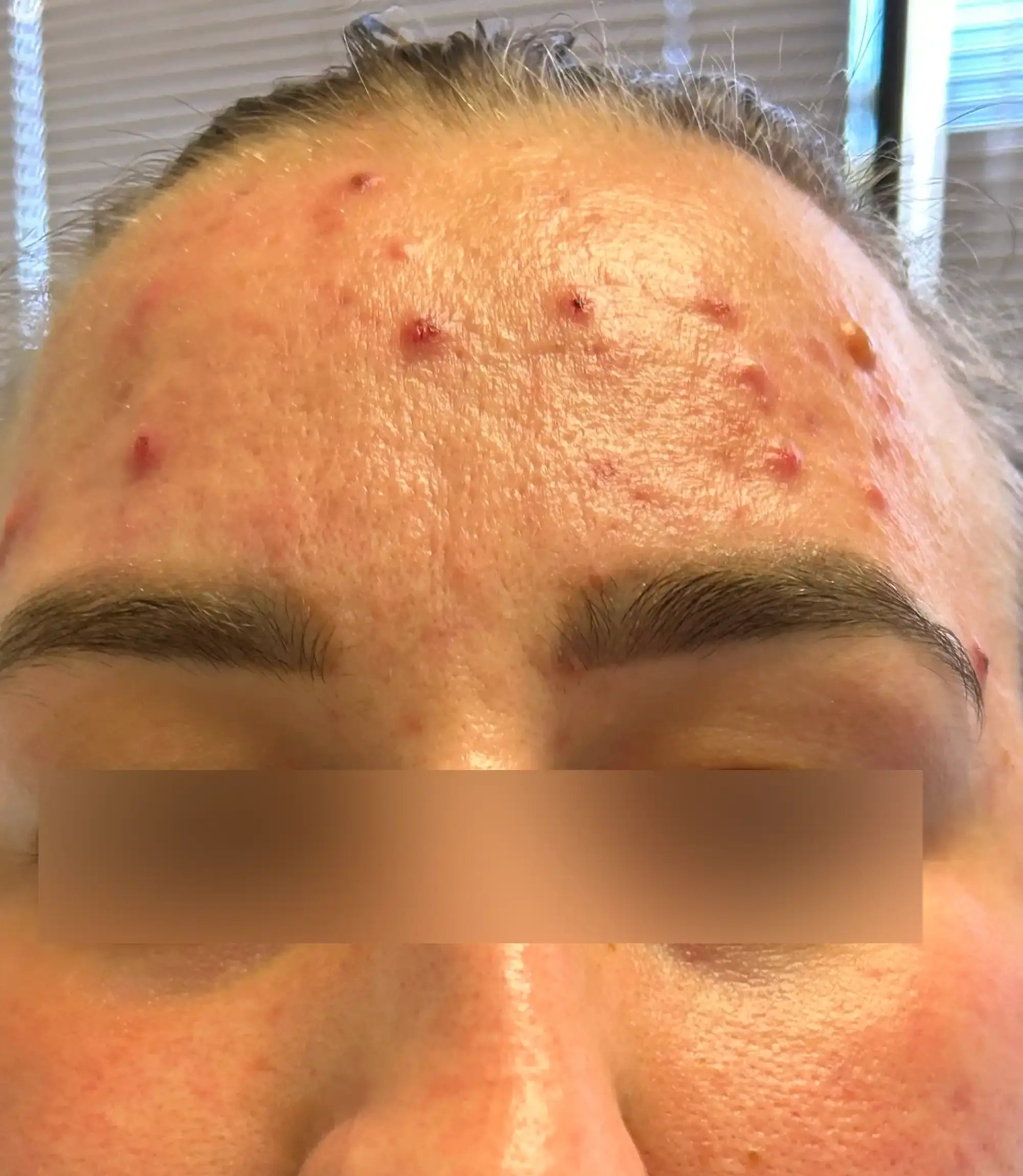 Before Image