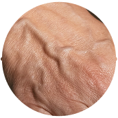 Hormonální řetězová reakce