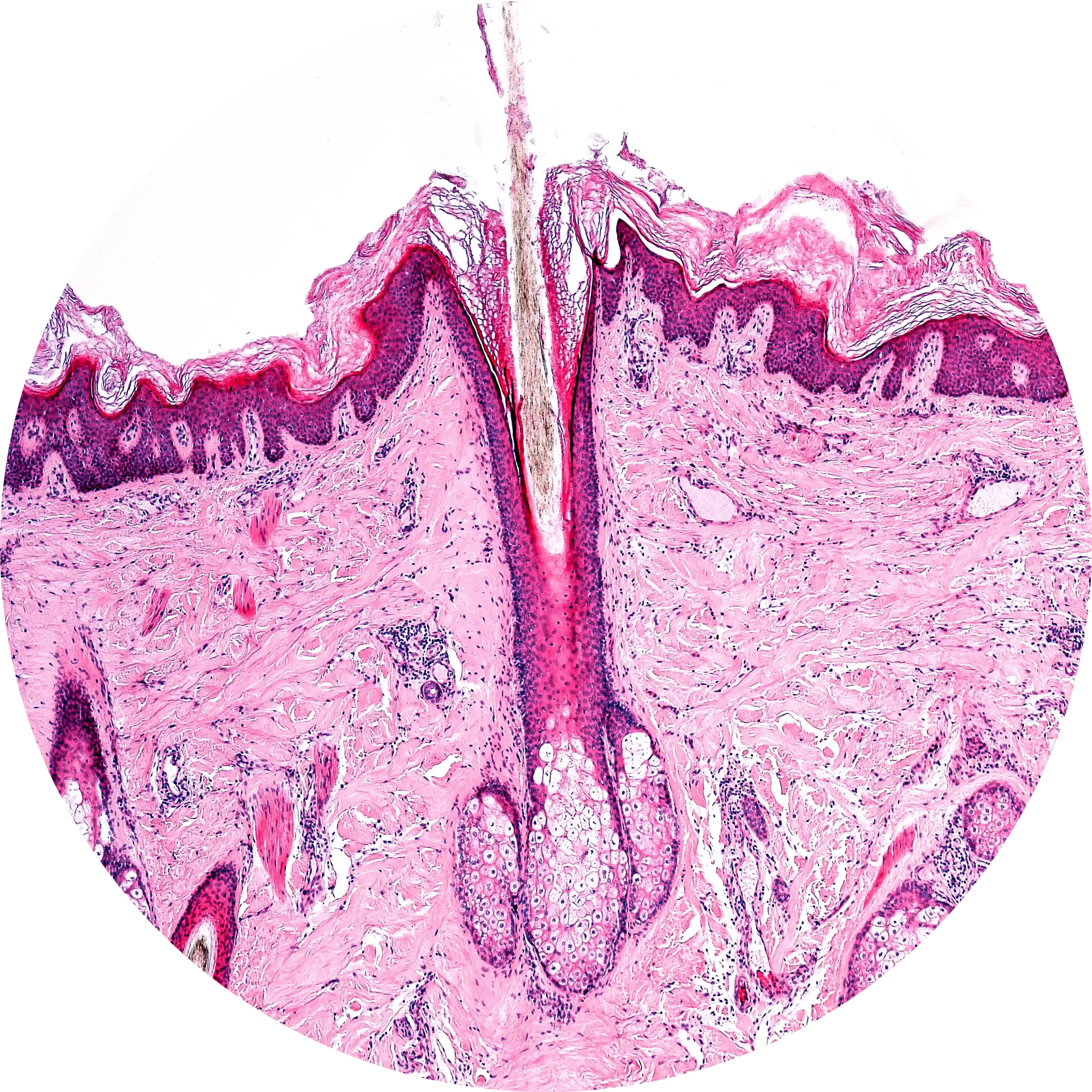 ODUMŘELÉ KOŽNÍ BUŇKY