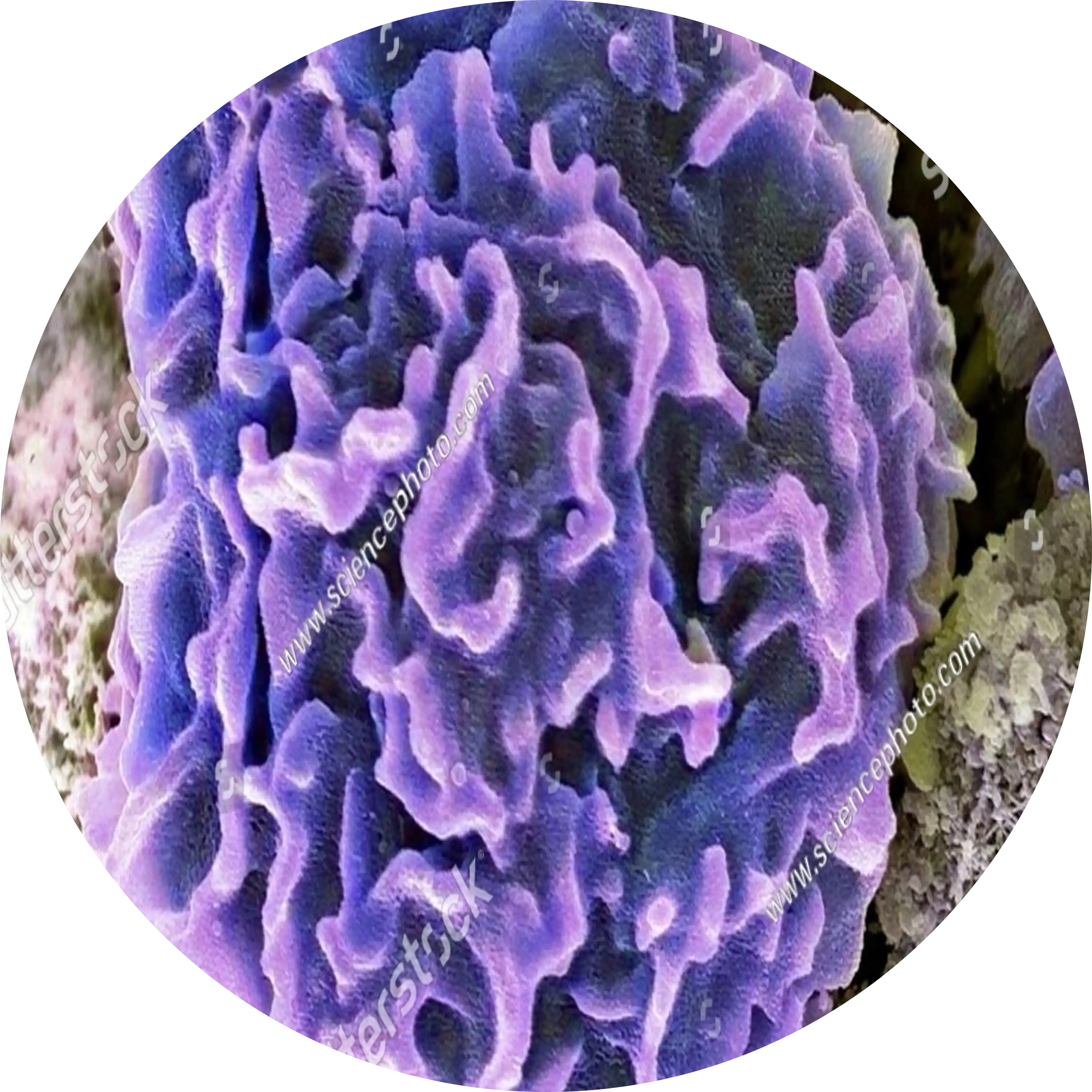 TENDENCE K ZANÍCENÍ