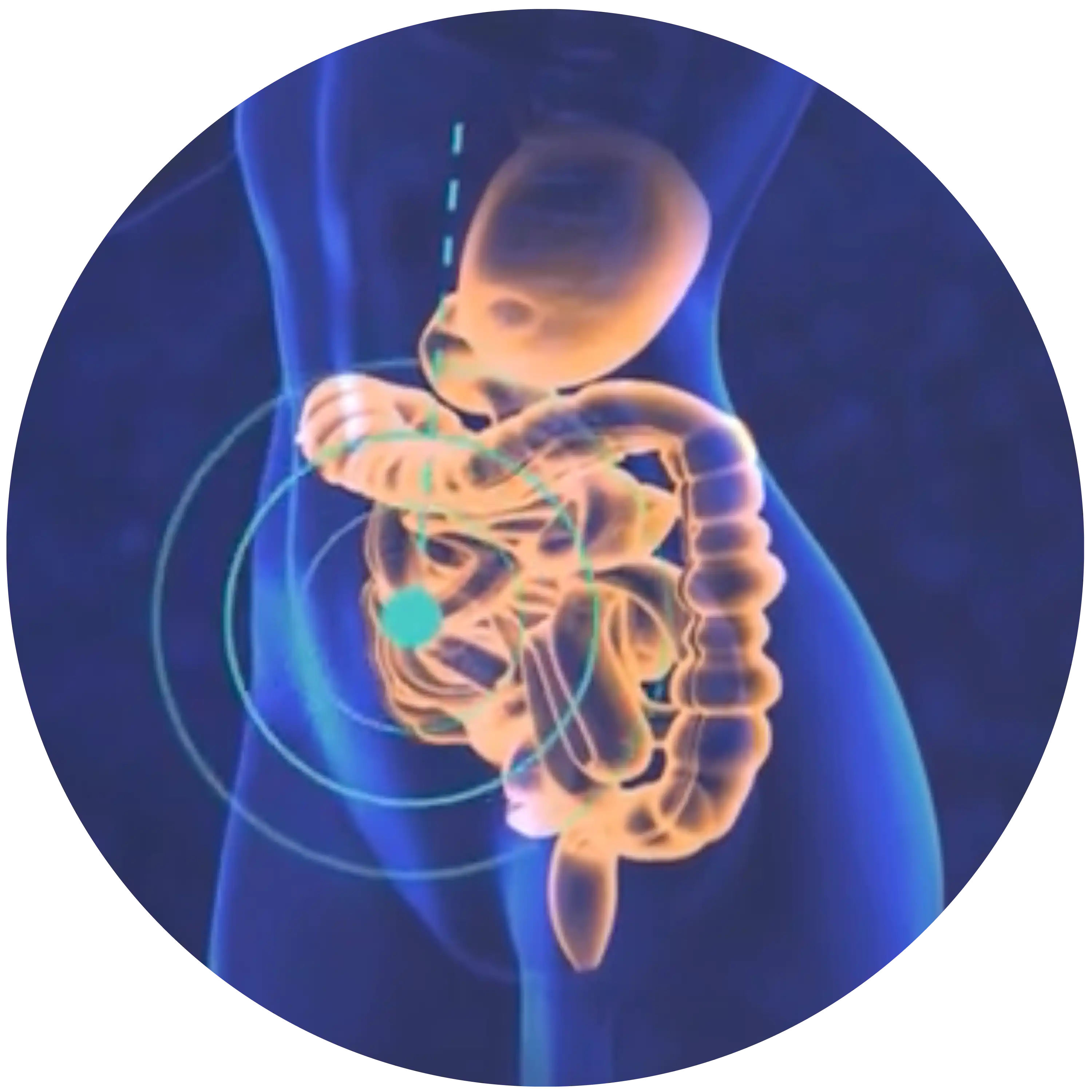 Oslabená střevní bariéra