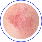 Zvýšená citlivost