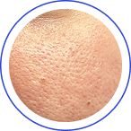 Nadměrná mastnota a suchá místa současně