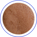 Zrychlené stárnutí